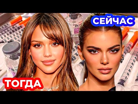 Видео: НАТУРАЛЬНОЙ КРАСОТЫ БОЛЬШЕ НЕТ: ПОКОЛЕНИЕ СДЕЛАННЫХ ЛИЦ И ПОЧЕМУ РАССМАТРИВАТЬ ФОТО ЗВЕЗД ОПАСНО