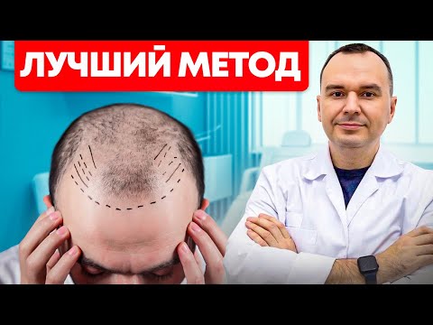 Видео: Пересадка волос. Какой метод выбрать: FUE или DHI | Александр Долгов