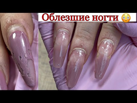 Видео: Облезшие ногти😳ТАКОЙ СМЕЛЫЙ ДИЗАЙН НЕ КАЖДАЯ РЕШИТСЯ СДЕЛАТЬ 😅