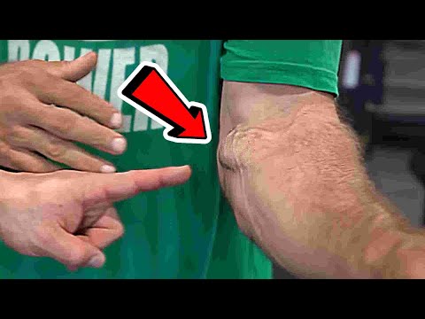 Видео: ПРОНАЦИЯ НЕ ИМЕЕТ ЗНАЧЕНИЯ в АРМРЕСТЛИНГЕ