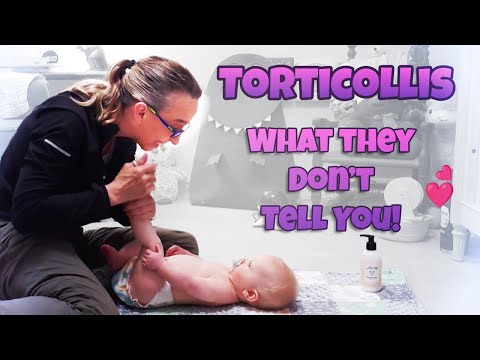 Видео: Сделайте ЭТО сначала при кривошее 👶🏼 | Массаж для сенсорной готовности | Физиотерапия #57