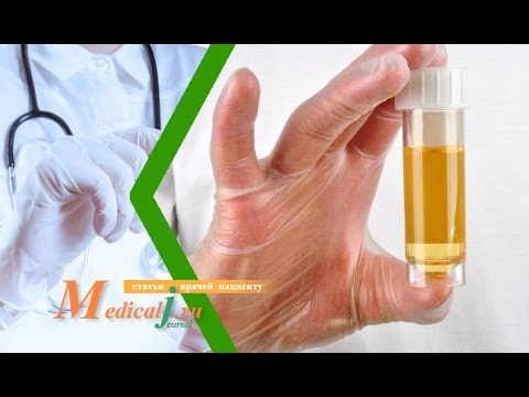 Видео: Мутная моча. Какие причины? Какие анализы сдать?