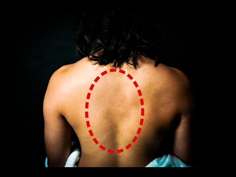 Видео: Что-то не так со спиной...