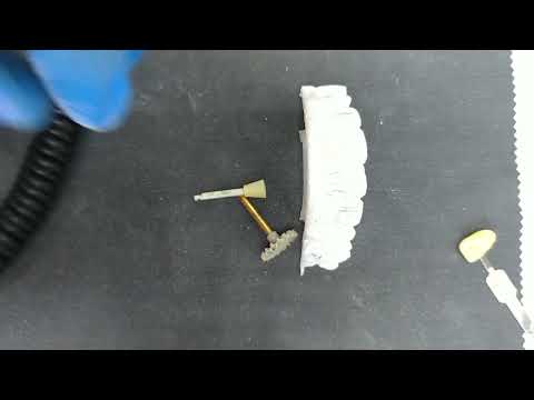 Видео: полировка композита , 3 шага