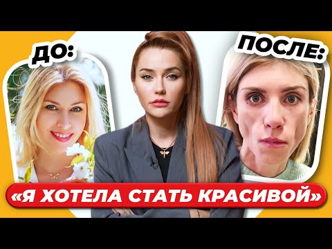 Видео: ЖИЗНЬ БЕЗ ЛИЦА: До и После пластики ❌ | ошибки пластических хирургов