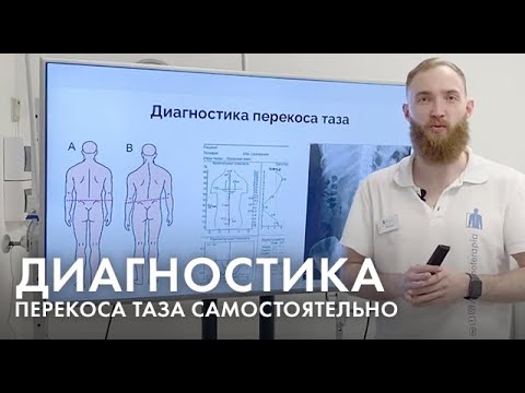 Видео: Диагностика перекоса таза у детей