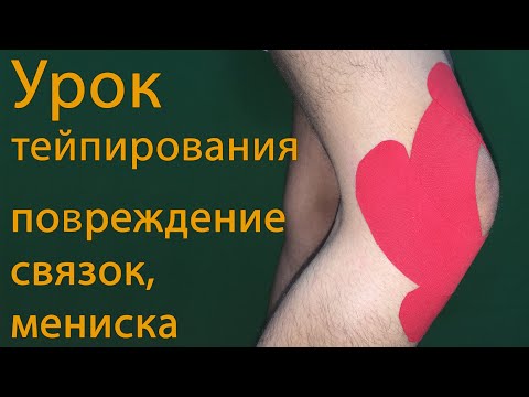 Видео: Урок тейпирования  коленного сустава при повреждении связок, мениска