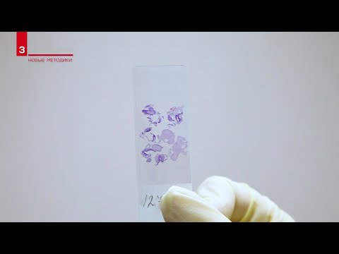 Видео: Гистология / Биопсия кожи в лаборатории CL LAB