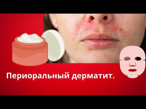 Видео: 5 критических ошибок, которые следует избегать при периоральном дерматите.