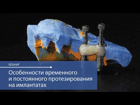 Видео: Особенности временного и постоянного протезирования на имплантатах