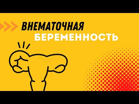 Видео: ВНЕМАТОЧНАЯ БЕРЕМЕННОСТЬ @DrOlenaB #внематочнаябеременность #эктопическая #беременность