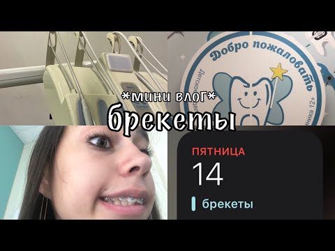 Видео: мне ставят брекеты... / mini vlog