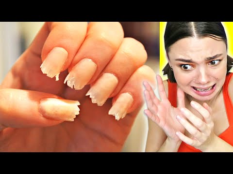 Видео: Это САМЫЙ УЖАСНЫЙ МАНИКЮР! Обгрызанные Ногти и Ногти Хинкали.
