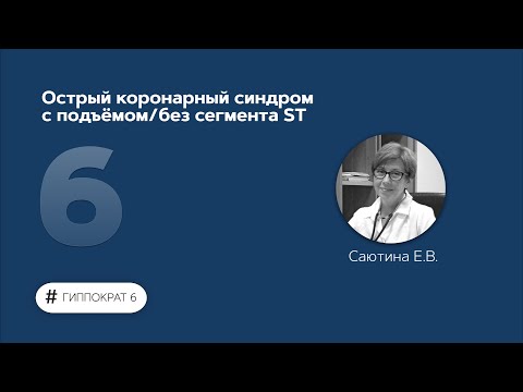 Видео: Острый коронарный синдром с подъёмом/без сегмента ST 13.02.23