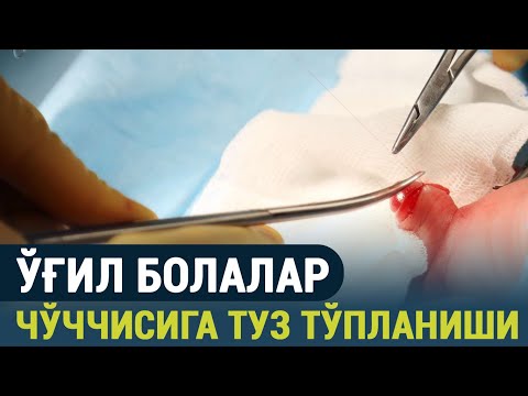 Видео: Ўғил болалар чўччисига (олатига) туз тўпланиши