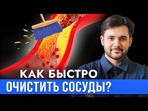 Видео: Можно Ли Очистить Сосуды в Домашних Условиях? Атеросклезора Больше НЕ БУДЕТ!