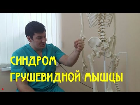 Видео: Синдром грушевидной мышцы  Piriformis syndrome
