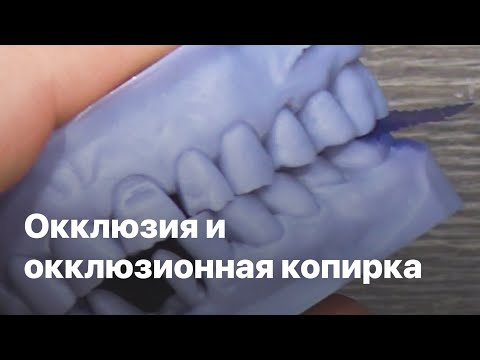 Видео: Окклюзия и окклюзионная копирка, окклюзионные контакты, проверка окклюзии копирка 8 микрон