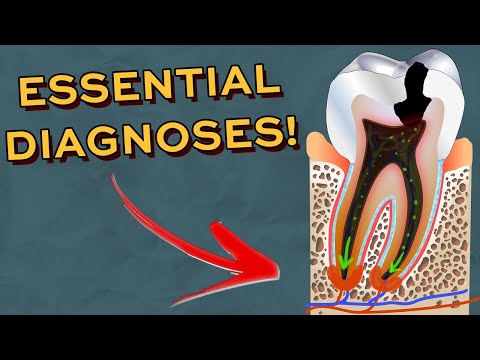 Видео: Все стоматологические диагнозы, которые вам НУЖНО знать при осмотре пациентов!