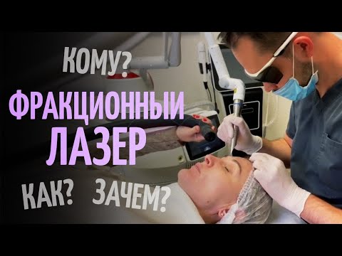 Видео: Лазерная шлифовка. Рубцы, морщины, пигментация. Как проходит процедура, чего ждать?