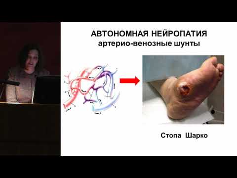 Видео: Комелягина Е.Ю., Важность ранней диагностики автономной диабетической нейропатии в ..