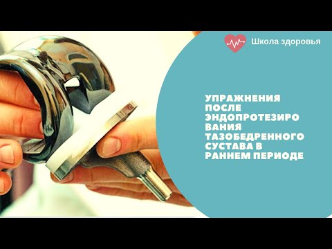 Видео: Упражнения после эндопротезирования тазобедренного сустава в раннем периоде.Часть 1