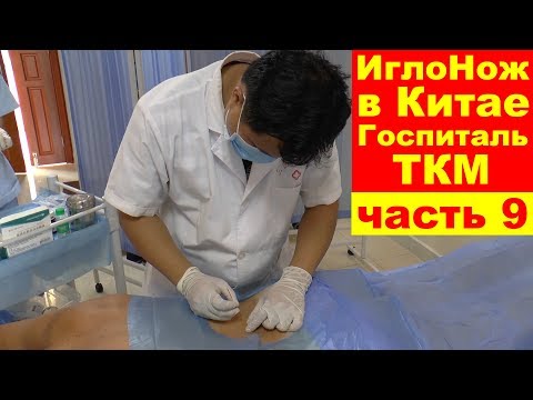 Видео: Эффективное лечение ИглоНожом в Китае. Госпиталь ТКМ. Санья. Хайнань. Китай 🏥