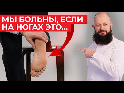 Видео: Как определить состояние здоровья по стопам человека? / Методы лечения ног