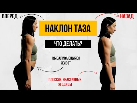 Видео: НАКЛОН ТАЗА. Как исправить наклон таза. Плоские ягодицы/Вываливающийся живот.