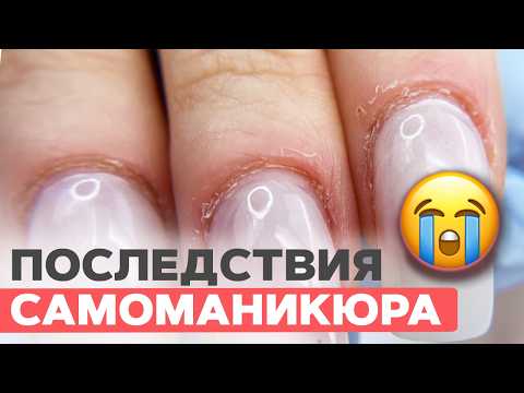 Видео: НЕ НАДО ТАК! Всё в заусенцах | Печальные последствия самостоятельного маникюра