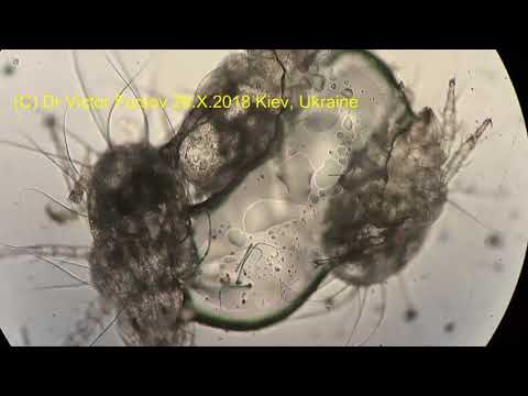 Видео: Миллион Мучных Клещей Acarus siro! Клещи Под Микроскопом.