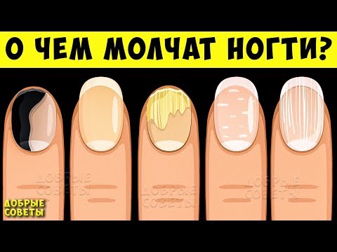 Видео: 5 вещей по которым ваши Ногти могут рассказать Всё о вашем Здоровье