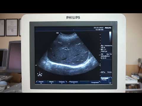 Видео: Philips HD7 обор ультразвукового сканера