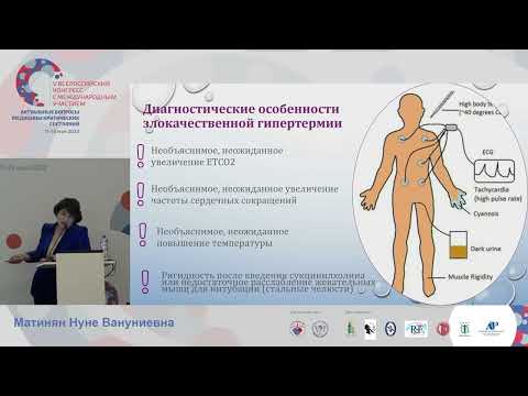 Видео: Злокачественная гипертермия Матинян Н.В.