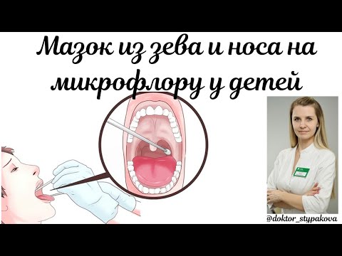 Видео: Мазок из зева и носа на микрофлора у детей. Зачем назначают данный анализ?