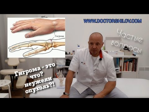 Видео: Гигрома (ганглион) или сухожильный ганглий. Просто и понятно.