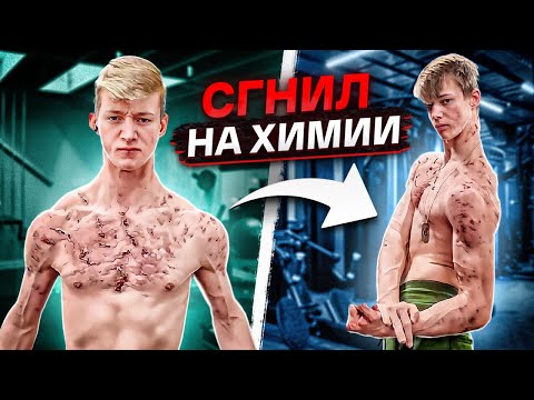 Видео: ЗАХИМИЧИЛ С ПЕРВОГО ДНЯ ТРЕНИРОВОК / жуткие последствия