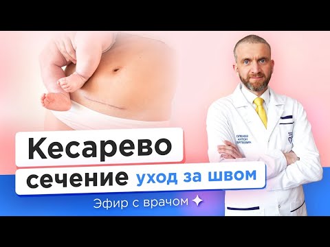 Видео: Кесарево сечение: уход за швом — Антон Оленев