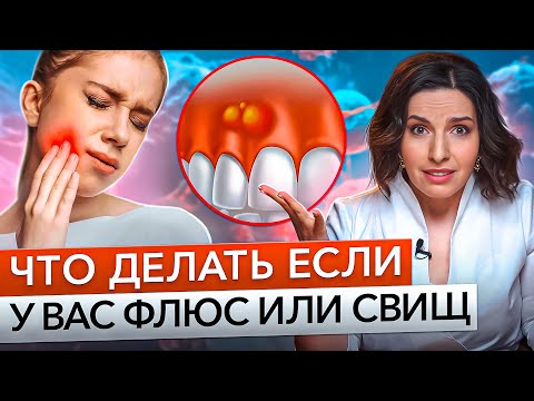 Видео: Чем опасен флюс и шишка на десне? КАК БЫСТРО ОТ НИХ ИЗБАВИТЬСЯ?