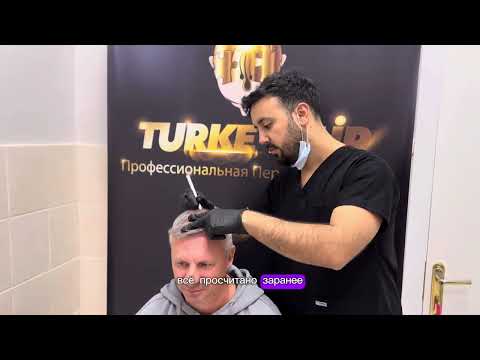 Видео: До и после!Пересадка волос в Москве 