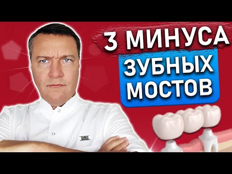 Видео: Почему зубные мосты — РИСК для зубов? НЕДОСТАТКИ при установке зубного моста, неочевидные минусы