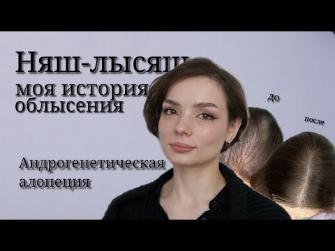 Видео: У меня андрогенетическая алопеция. #ugolekmakeup #ага #алопеция #ялысею