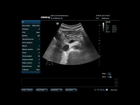 Видео: Ветви БА для студентов 2022 11 10 09 27 45