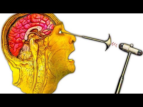 Видео: 5 Жутких древних медицинских процедур