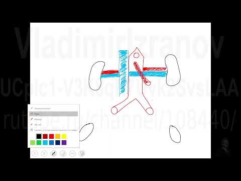Видео: Аорто-мезентериальный пинцет. Рисуем схему на доске. Запись  2022 12 23 14 05 35