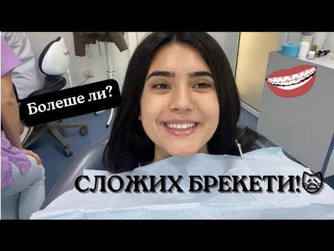 Видео: СЛОЖИХ БРЕКЕТИ🦷/БОЛЕШЕ ЛИ?/КАК СЕ ВЪЗПРИЕХ/YANITSA KUZMANOVA