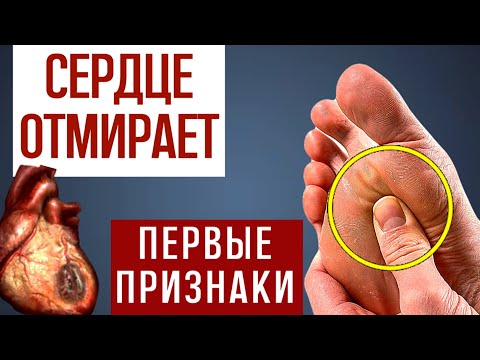 Видео: 12 Признаков того, что Ваше СЕРДЦЕ ОТМИРАЕТ! 90% даже НЕ Догадываются…