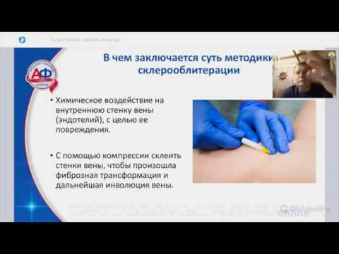 Видео: Семенов А. Ю. - Склеротерапия как искусство! 20 летний опыт склеротерапии: тактика, техника, нюансы.