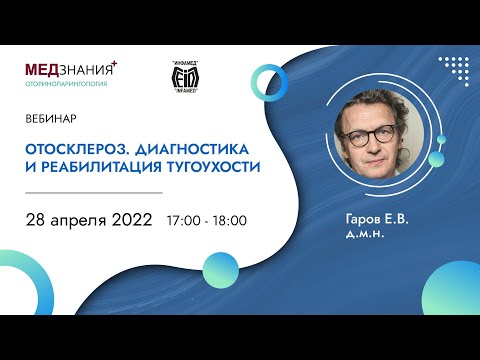 Видео: Отосклероз. Диагностика и реабилитация тугоухости