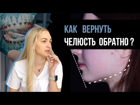 Видео: Дистальный прикус. Или как вернуть челюсть обратно?